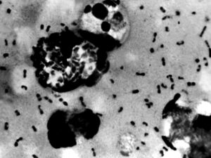 Microscopia P&B de bacilos escuros e grandes células irregulares